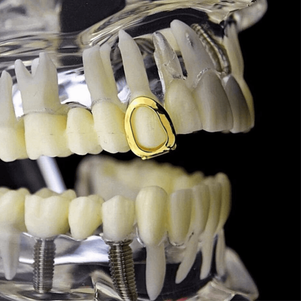 Canine Open Face Single Cap Grillz 14K - ICECI